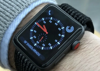 研究表明AppleWatch是镰状细胞患者的潜在低成本设备