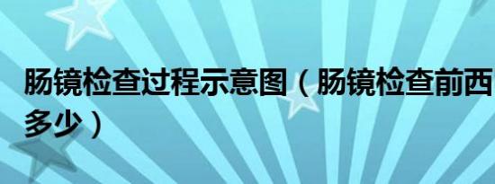 肠镜检查过程示意图（肠镜检查前西甲硅油喝多少）